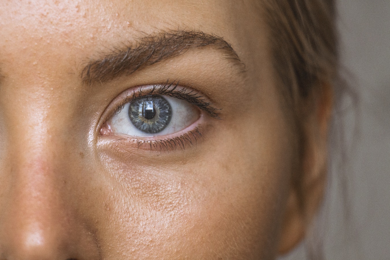 Cómo cuidar el rostro tras el verano